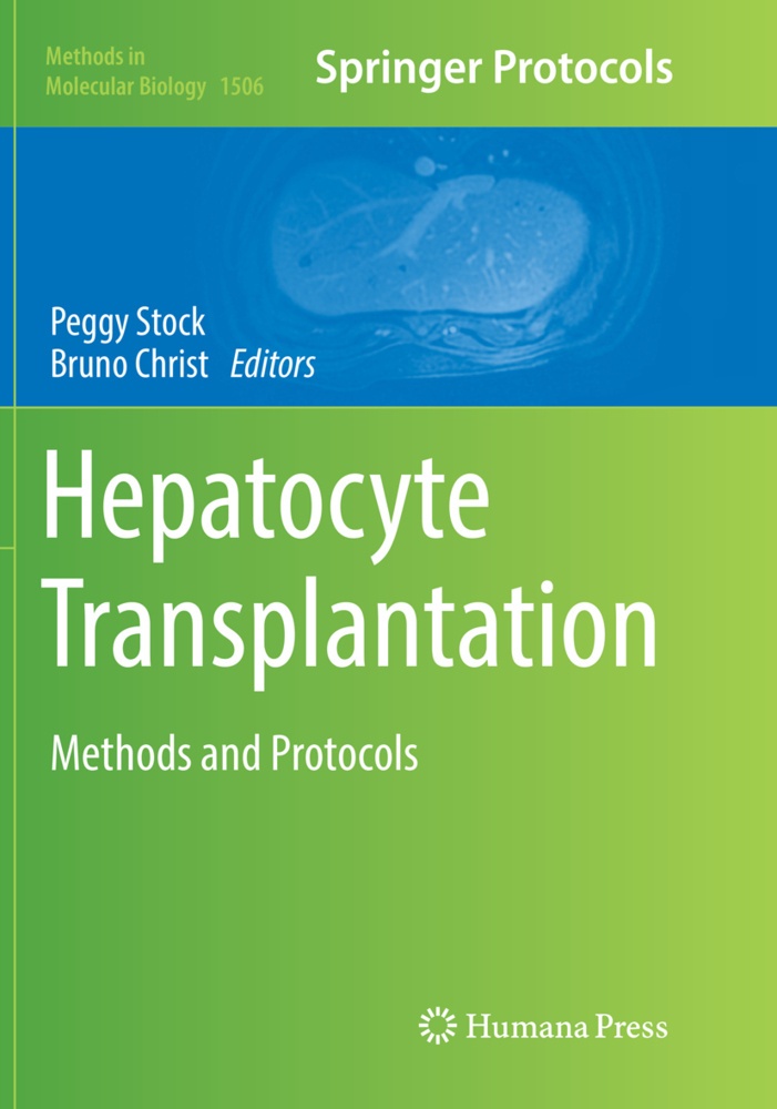 Hepatocyte Transplantation  Kartoniert (TB)
