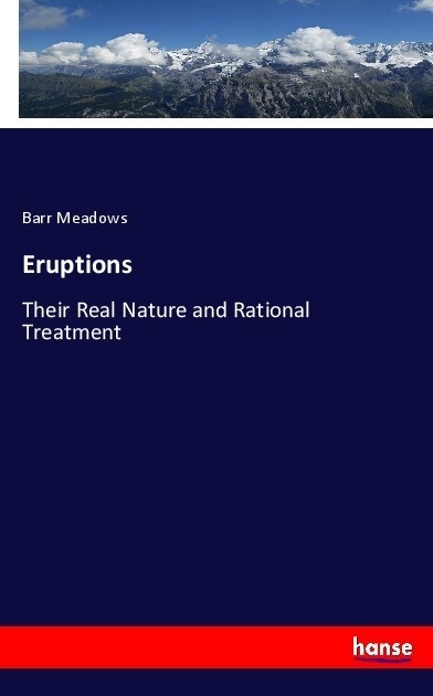 Eruptions - Barr Meadows  Kartoniert (TB)