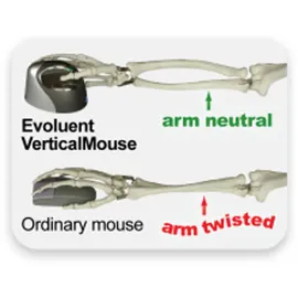 Evoluent VerticalMouse 4 Small schwarz/lila