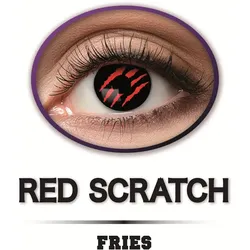 Fries - Fun-Linsen Scratch