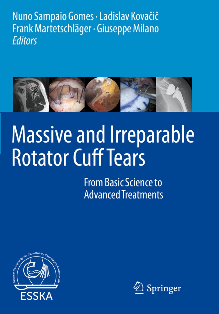 Massive And Irreparable Rotator Cuff Tears  Kartoniert (TB)