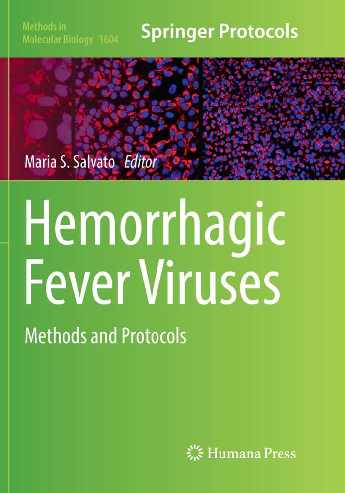Hemorrhagic Fever Viruses  Kartoniert (TB)