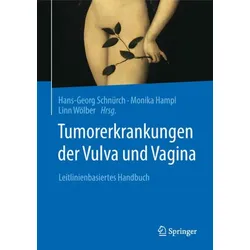 Tumorerkrankungen der Vulva und Vagina