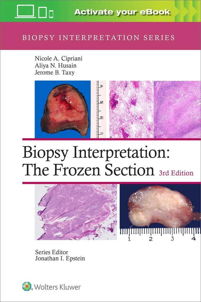 Biopsy Interpretation: The Frozen Section: Buch von Nicole A. Cipriani/ Aliya N. Husain/ Jerome B. Taxy