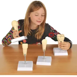 Die vier Zahnarten im Vergleich, 4 Modelle