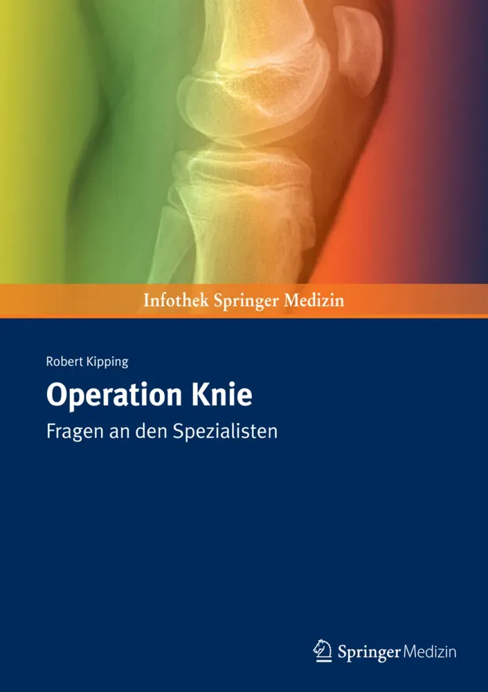 Operation Knie - Robert Kipping  Kartoniert (TB)