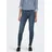 Only "ONLWAUW LIFE MID SK DNM", Damen, Gr. M (38), Länge 30, blau (blau schwarz denim), Denim/Jeans, Obermaterial: 64% Baumwolle, 31% Polyester, 3% Viskose, 2% Elasthan, unifarben, skinny fit, Jeans 5-Pocket-Jeans