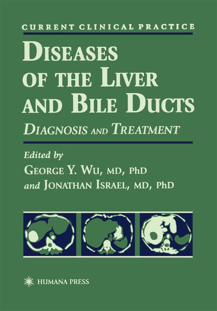 Diseases Of The Liver And Bile Ducts  Kartoniert (TB)
