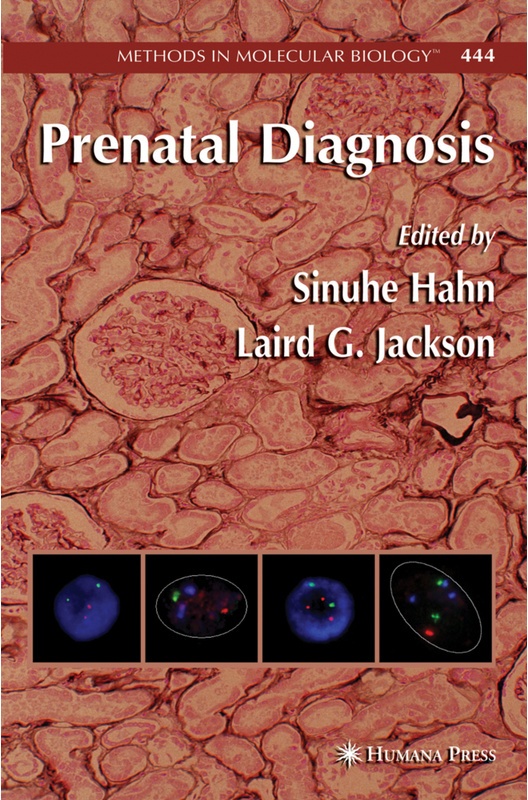 Prenatal Diagnosis, Kartoniert (TB)