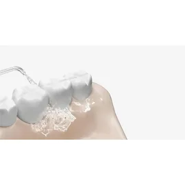 Xiaomi Water Flosser 2