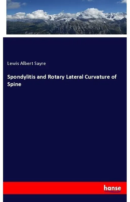 Spondylitis And Rotary Lateral Curvature Of Spine - Lewis Albert Sayre  Kartoniert (TB)