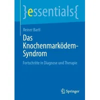 Springer Das Knochenmarködem-Syndrom: Taschenbuch von Reiner Bartl