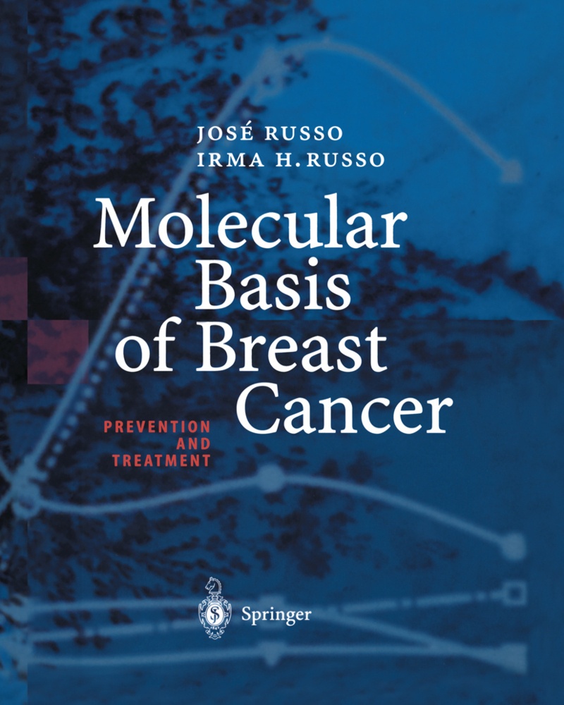 Molecular Basis Of Breast Cancer - Jose Russo  Irma H. Russo  Kartoniert (TB)