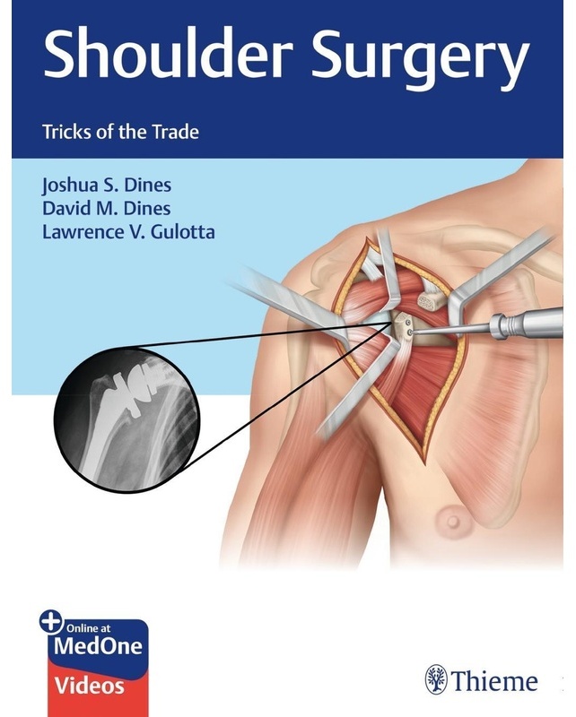 Shoulder Surgery - Joshua Dines  David M. Dines  Lawrence V. Gulotta  Gebunden