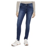 TOM TAILOR Damen Jeans Alexa Skinny mit Doppelknopf-Verschluss, Gr. 33 - Blau / 33,33/33