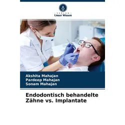 Endodontisch behandelte Zähne vs. Implantate