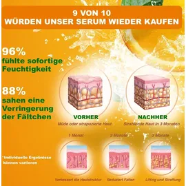 P-Beauty Anti-Falten Serum mit Vitamin C und E Hyaluronsäure Anti Aging Falten Vegan, 1x 120ml