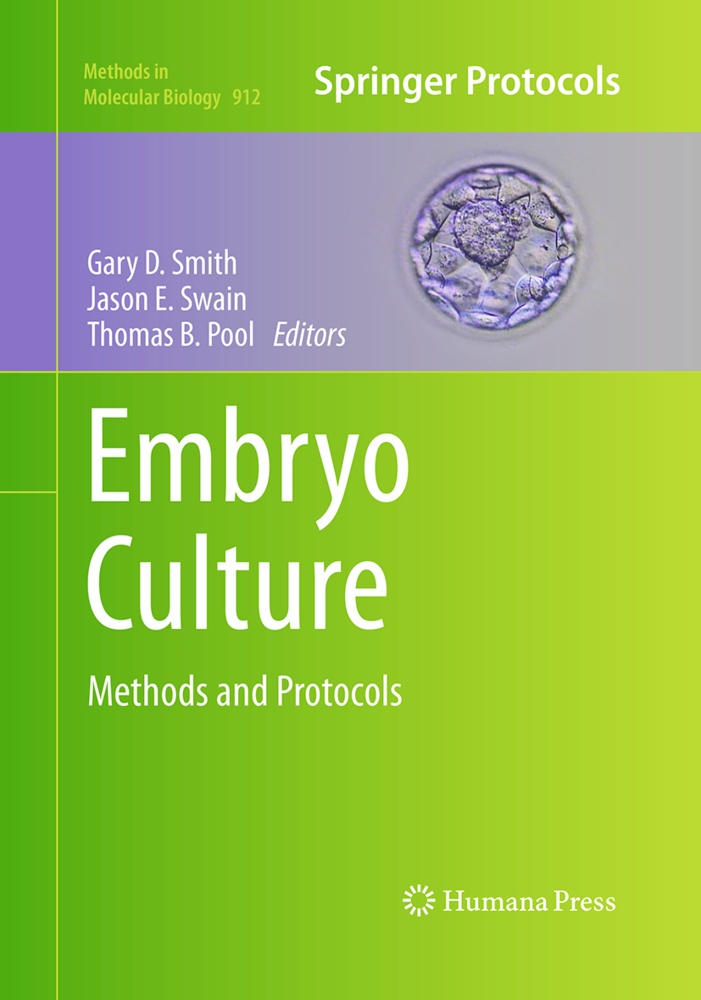 Embryo Culture  Kartoniert (TB)