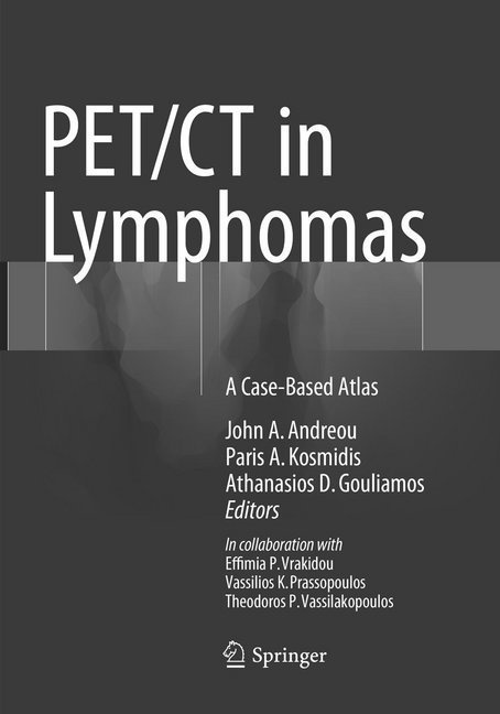 Pet/Ct In Lymphomas  Kartoniert (TB)