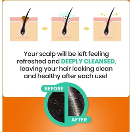 Sulsena Anti-Schuppen Shampoo mit natürlichem Peeling 150 ml