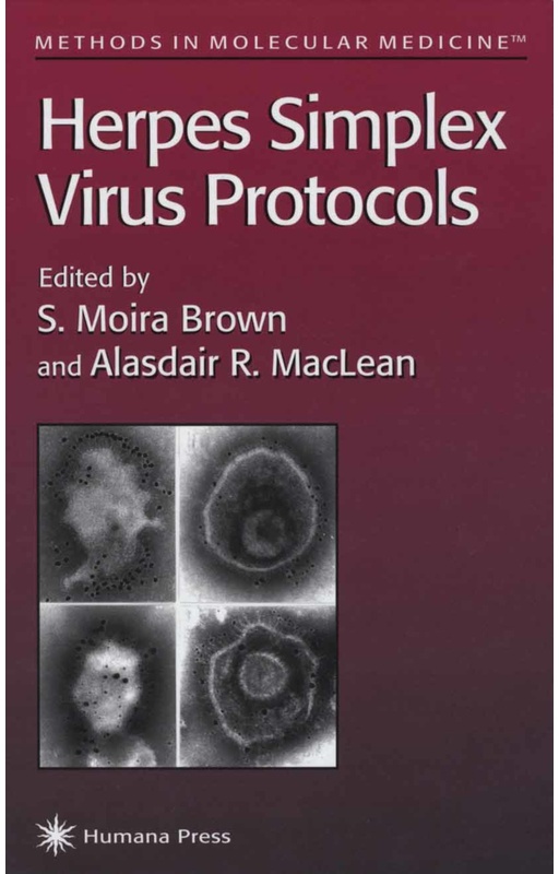 Herpes Simplex Virus Protocols, Kartoniert (TB)
