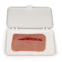 Wundmoulage Schnittwunde