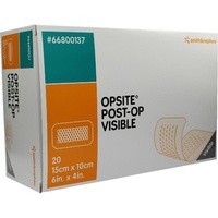 Smith & Nephew GmbH - Woundmanagement Opsite Post OP Visible 15x10cm