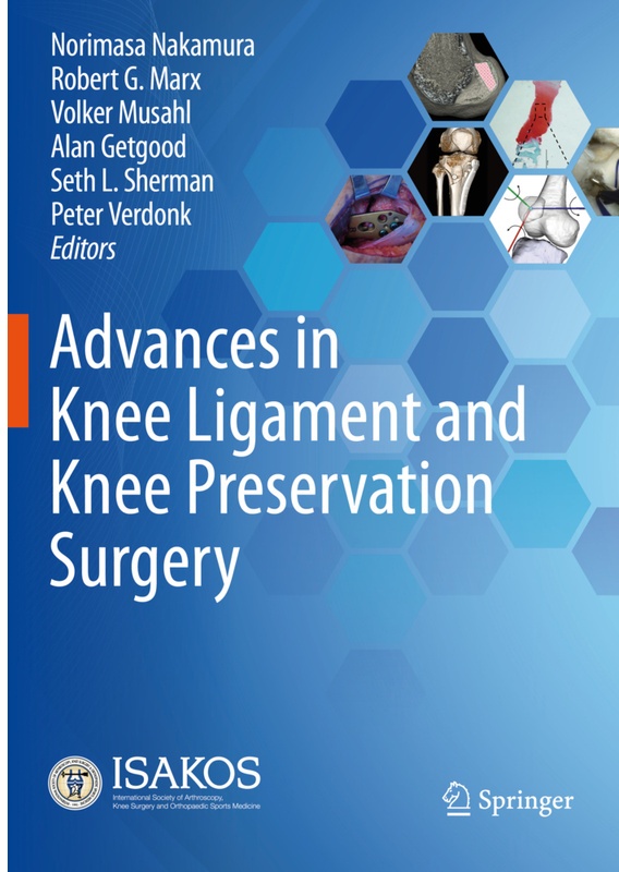 Advances In Knee Ligament And Knee Preservation Surgery, Kartoniert (TB)
