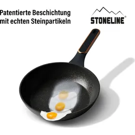 STONELINE Kochgeschirr-Set 11-teilig 18/20/24 Roségold | mit Deckeln | Schwarz