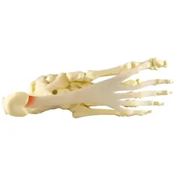 Modell des Fußes/Knöchels mit Plantarfasziitis