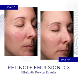 Is Clinical Retinol+ Emulsion 0,3 30 ml