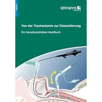 Lehmanns Media Von der Tracheotomie zur Dekanülierung