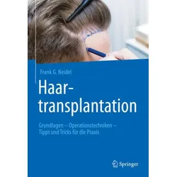 Haartransplantation