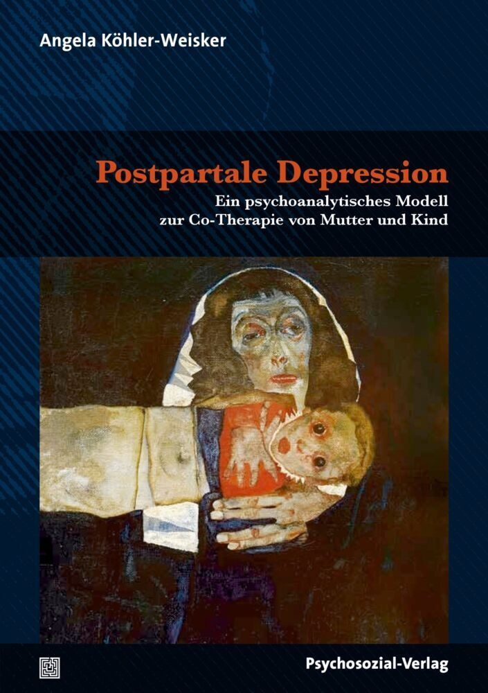 Postpartale Depression - Angela Köhler-Weisker  Kartoniert (TB)