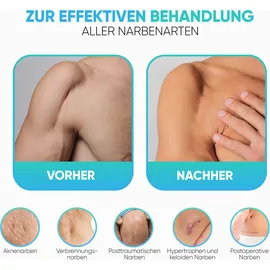 Health Press Narbengel 50 ml