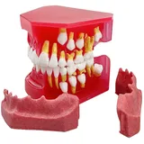 Milchzahnmodell für Kinder, 1: 1-Ersatzzahnmodell, Oralmodell, Milchzahn, alternatives Anzeigemodell, Zahnmodell
