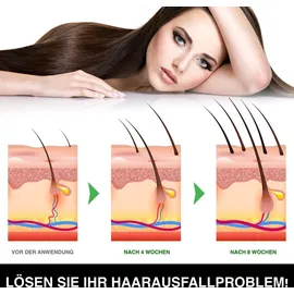 Aliver Haarwachstum Shampoo Rizinus Lavendel Argan 300 ml