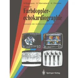 Atlas Der Farbdopplerechokardiographie - Nikola Bogunovic  Hermann Mannebach  Harm Ohlmeier  Kartoniert (TB)