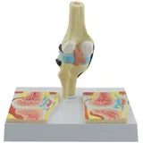HEINESCIENTIFIC Kniegelenk-Modell Rheumatisch Knie-Modell Rheuma HeineScientific