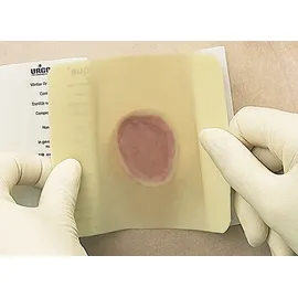 Urgo Medical Algoplaque 20 x 20 cm