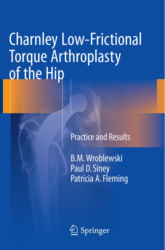 Charnley Low-Frictional Torque Arthroplasty Of The Hip - B.M. Wroblewski, Paul D. Siney, Patricia A. Fleming, Kartoniert (TB)