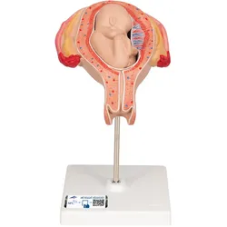 Fetus Modell, 5. Monat, Steißlage - 3B Smart Anatomy