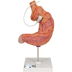 Magenbandmodell - 3B Smart Anatomy