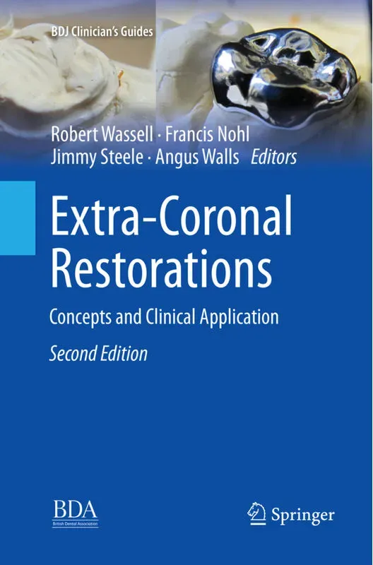 Extra-Coronal Restorations, Kartoniert (TB)