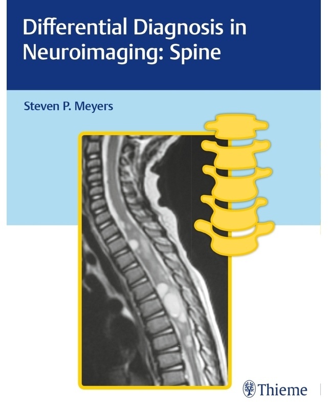 Differential Diagnosis In Neuroimaging / Differential Diagnosis In Neuroimaging: Spine; ., Gebunden