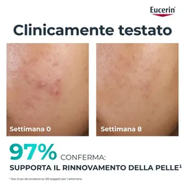 Eucerin DermoPure Clinical Peeling 10 Nachtcreme 40 ml