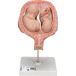 Zwillingsfeten Modell, 5. Monat, normale Position - 3B Smart Anatomy