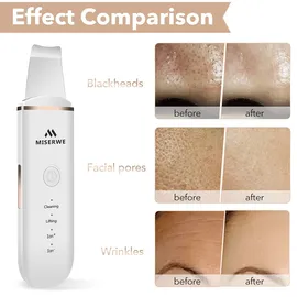 Miserwe Scrubber Face Spatula