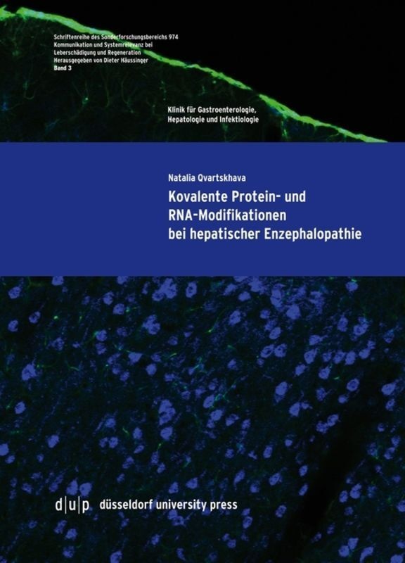 Kovalente Protein- Und Rna-Modifikationen Bei Hepatischer Enzephalopathie - Natalia Qvartskhava  Kartoniert (TB)
