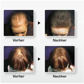 BioTHIK Haaraufbau-Faser S8 wheat blond 25g Alkoholfrei Pulver Haarwuchs und Haarverdickung Unisex-Erwachsene